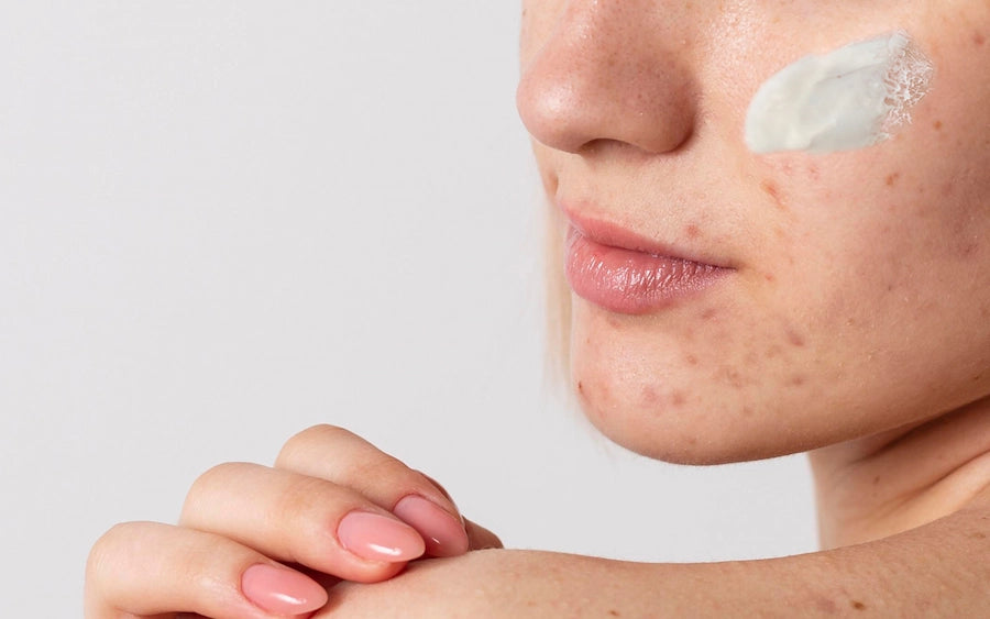 how to use main image