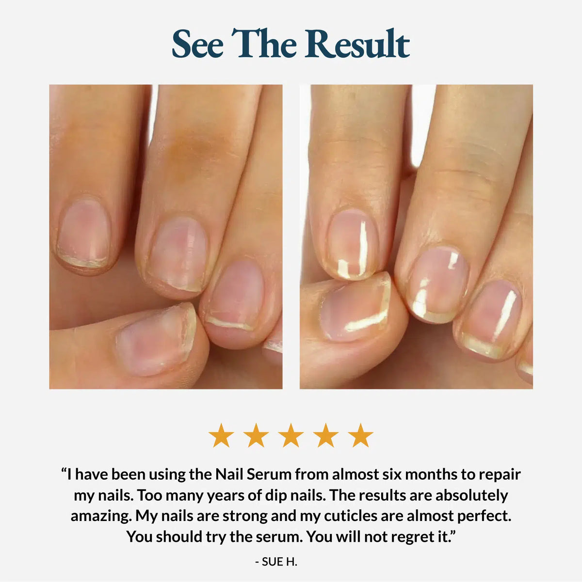 Nail Strengthener and Growth Serum - Nail Care Pro