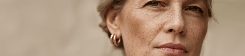 How to Get Rid of Dark Spots on Face: Causes, Care & Prevention