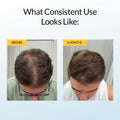 Herbal Hair Growth Shampoo - Test Jul 20