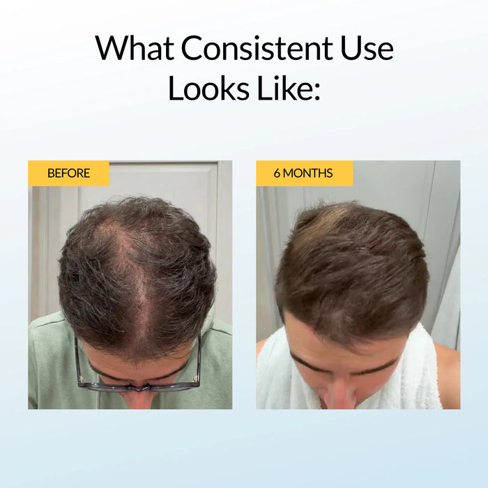 Herbal Hair Growth Shampoo - Test Jul 20