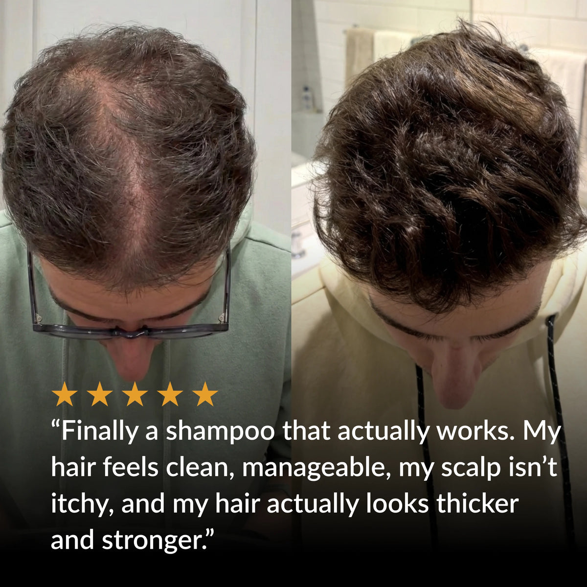 Herbal Hair Growth Shampoo