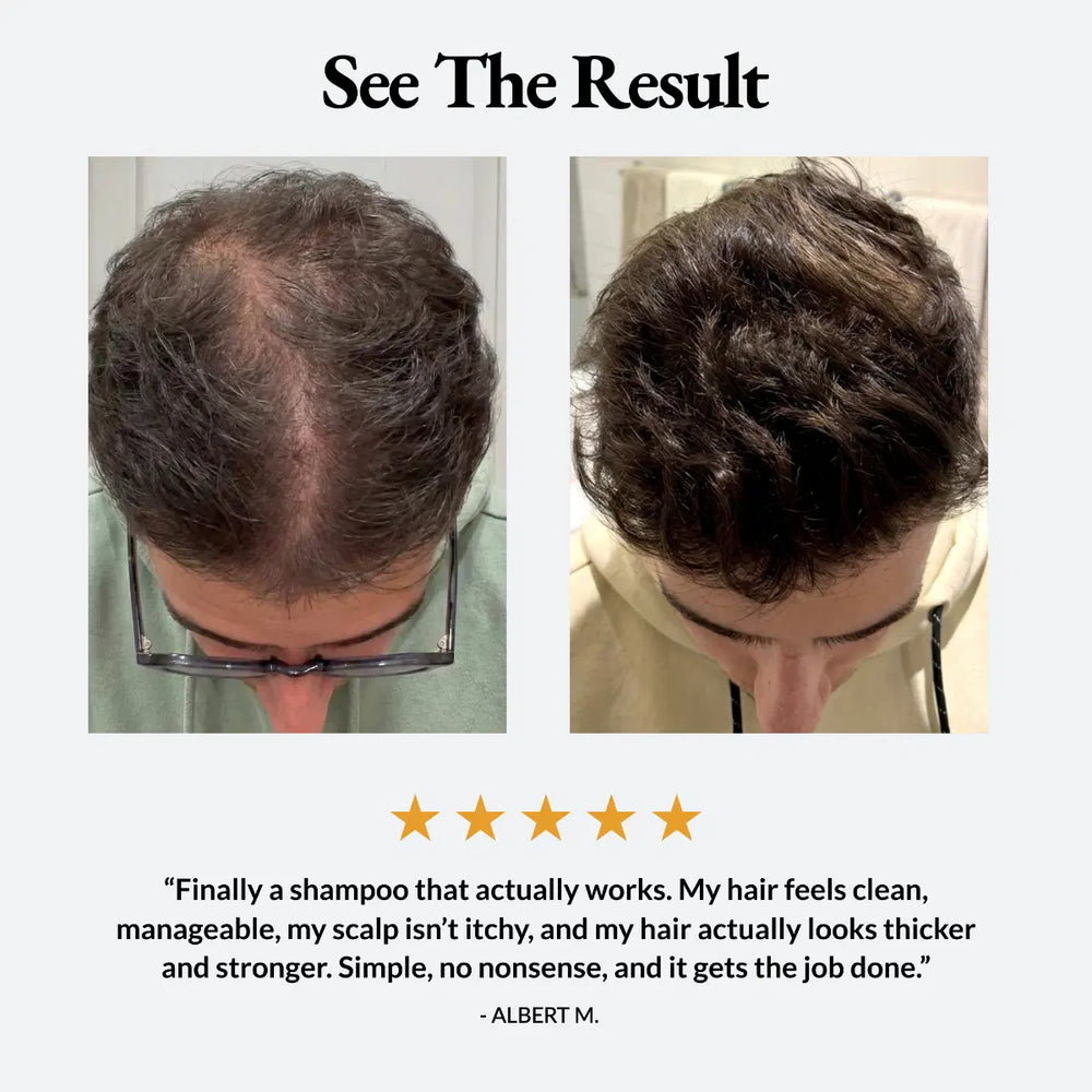 Herbal Hair Growth Shampoo