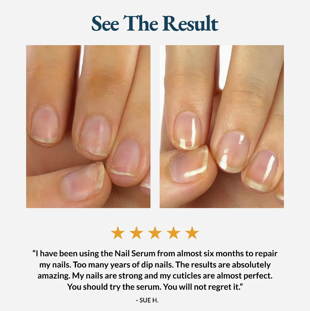 Nail Strengthener and Growth Serum - Nail Care Pro