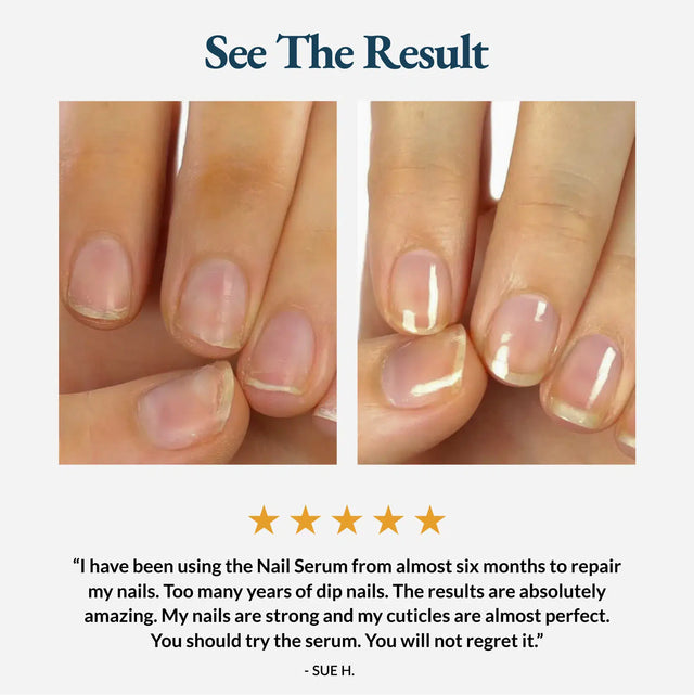 Nail Strengthener and Growth Serum - Nail Care Pro