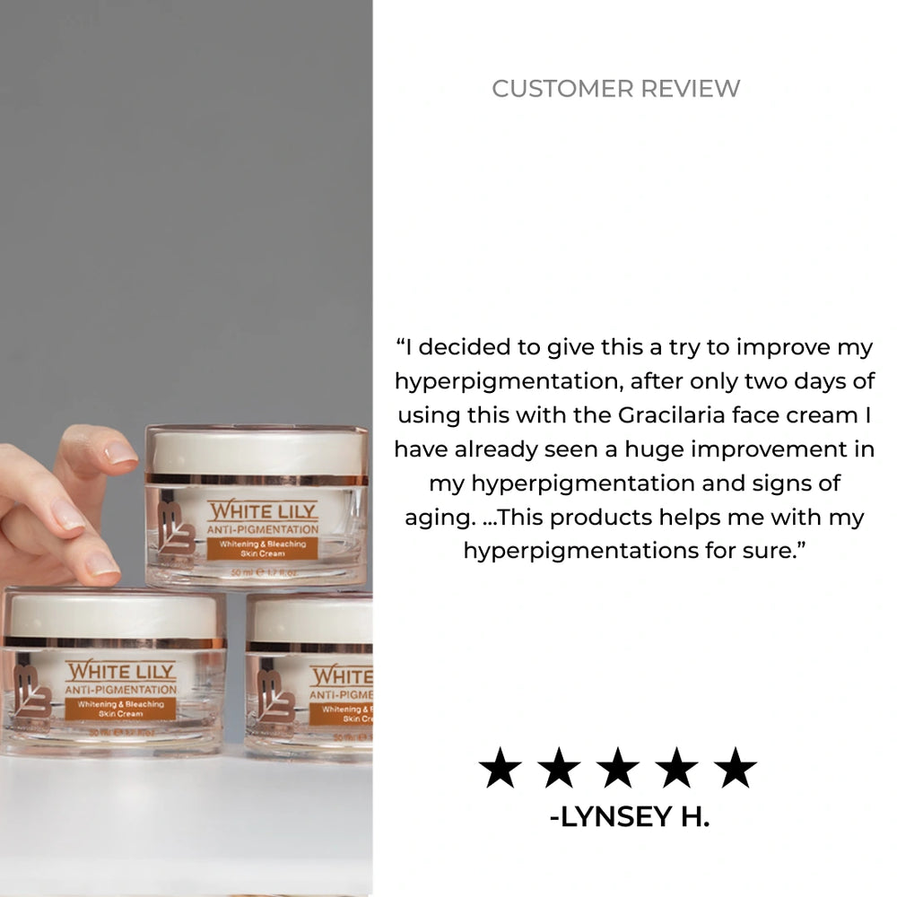White Lily - Pigmentation Cream for Dark Spots